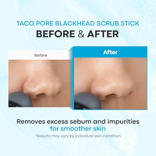 TONYMOLY Tako Pore Clay Scrub Stick, Korean Blackhead Exfoliator, 0.8 oz