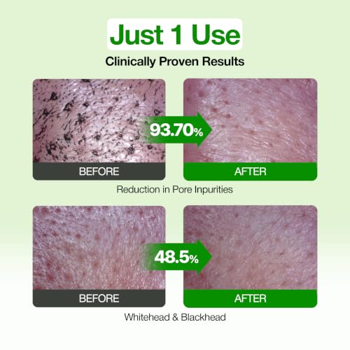 FULLY Green Tomato Pore Clay Mask Cleanser for Deep Cleansing, 4.05 fl oz