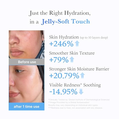 medicube Jelly Cream with Hyaluronic Acid for Long-lasting Hydration