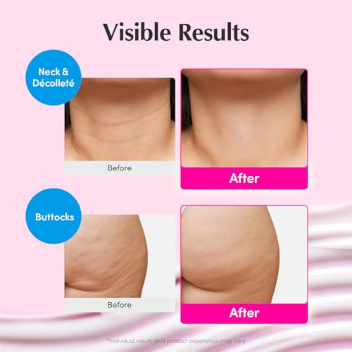 EQQUALBERRY NAD+ Peptide Boosting Cream – NAD+ 5% & 13 Peptides Anti-Aging Korean Skincare Face & Body Cream | Firming & Lifting Pink Neck Cream for Sagging Skin (1.69 fl.oz / 50ml)