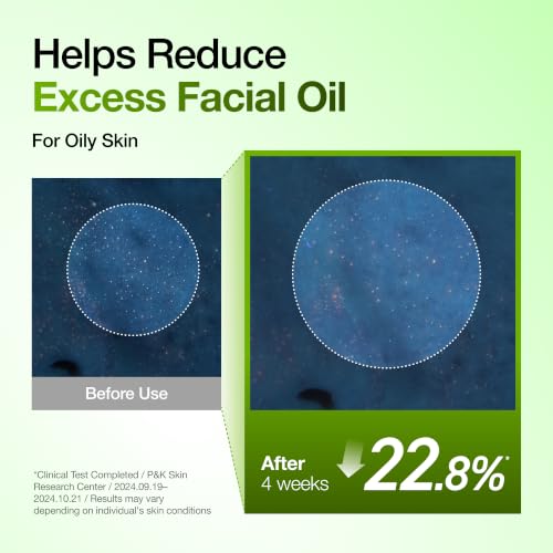 Anua Azelaic Acid 10 Hyaluron Redness Soothing Serum, 1.01 fl oz