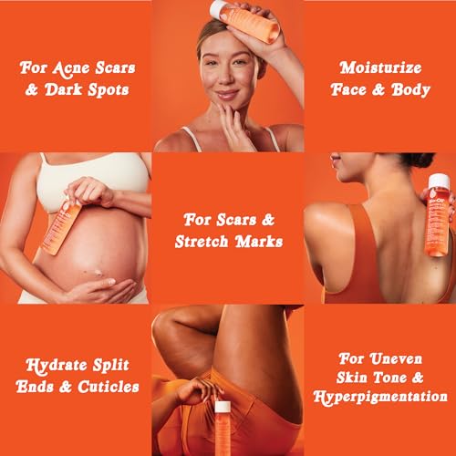 Bio-Oil Skincare Body Oil Serum, Scars & Stretch Marks, 6.7 fl oz