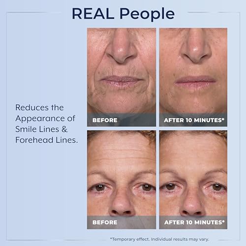 Plexaderm Eye Serum Pump - Visibly Reduces Bags, Wrinkles & Dark Circles