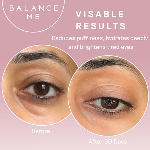 Balance Me Wonder Eye Cream, 0.5 fl oz, For Dark Circles