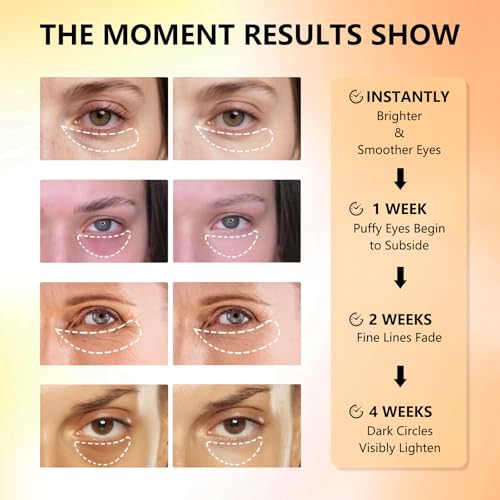 Aeryea Vitamin C & Caffeine Under Eye Patches for Men & Women 30 Pairs