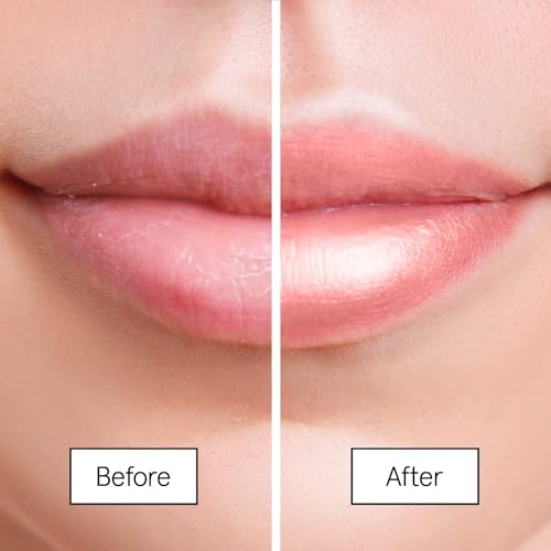 grace & stella Award Winning Lip Butter - Hydrating Lip Balm (1 - Pack)