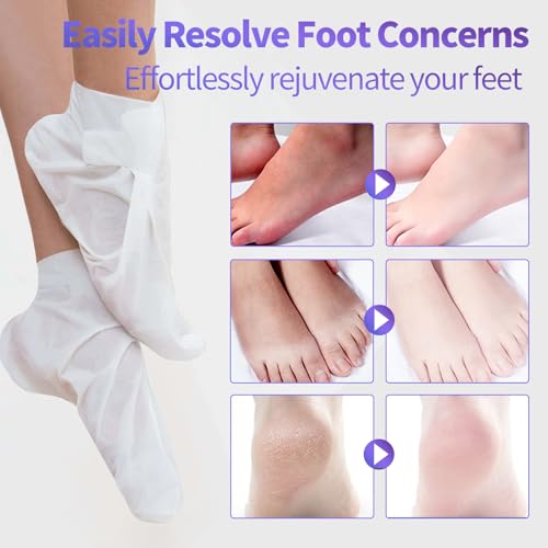 5 Pack Moisturizing Foot Mask, Hydrating Feet Mask for Dry Cracked Feet, Moisturizing Foot Socks Dry Skin Moisturizer for Soft Smooth Feet, Foot Spa Care Kit, Ideal Holiday Gift for Women and Men