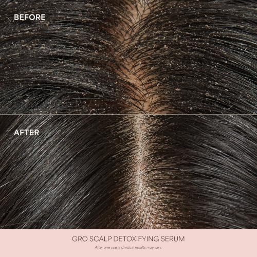VEGAMOUR GRO Scalp Detoxifying Serum, Scalp Serum with Zinc PCA Removes Buildup & Soothes Scalp, Natural Citrus Scent, 2 fl. oz.