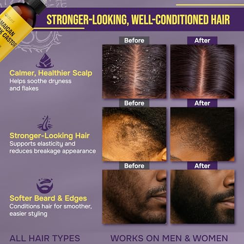 4oz Organic Cold Pressed Jamaican Black Castor Oil for Hair Growth and Damaged, Dry Scalp - Unscented, Hexane-Free