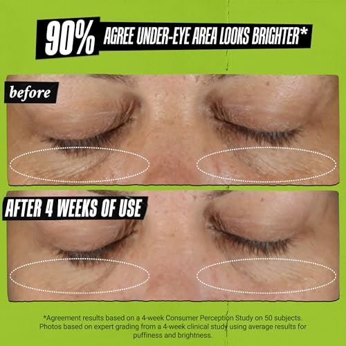 Kiehl's - Avocado Eye Treatment, for Dry Lines & Puffiness - 0.5 fl oz