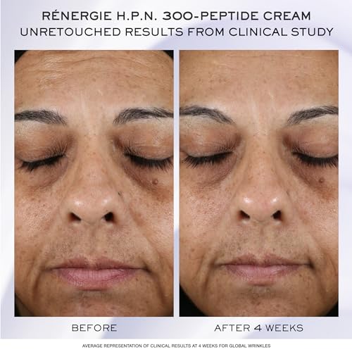 Lancôme Rénergie Skincare Trial Gift Set -Trial Set for Anti-aging Skincare Routine With Genifique Ultimate, Rénergie Day/Night Cream, and Eye Cream (1.6 Fl Oz)