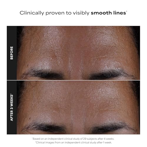 Paula's Choice SKIN PERFECTING 2% BHA Liquid Exfoliant, 4 Fl Oz