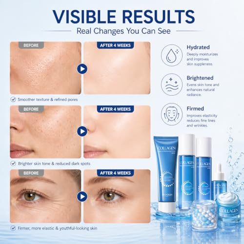 Collagen Skincare Set for Women – 6Pcs Face Care Kit with Cleanser,Toner,Serum,Eye Cream,Face Lotion & cream – Hydrating,Firming & Nourishing Routine,Gentle for All Skin Types,Great Gift Idea