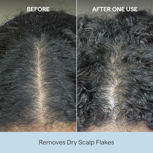 Briogeo Scalp Revival Charcoal + Coconut Oil Micro-Exfoliating Shampoo | Sulfate-Free Scalp Scrub for Dry, Itchy, or Oily Scalp | Detoxifying & Hydrating | Vegan & Cruelty Free | 8 oz
