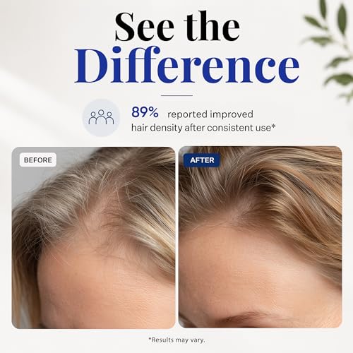 Scalp Delivery AM/PM GHK-Cu Peptide Scalp Serum | Stem Cell Hair Serum with Redensyl + Capixyl + AnaGain + Procapil | Multi-Peptide for Hair Density | 2 × 30 mL