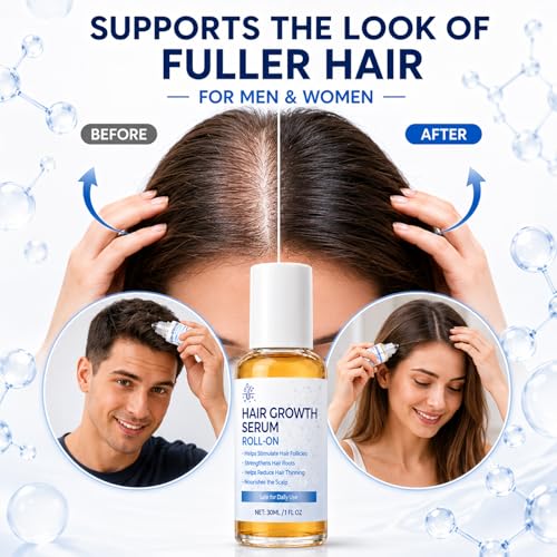 Hair Growth Serum Roll On 30ml with Rosemary Oil Redensyl AnaGain Fast Absorbing Scalp Care Hair Growth Serum Roll On for Thinning Hair and All Types