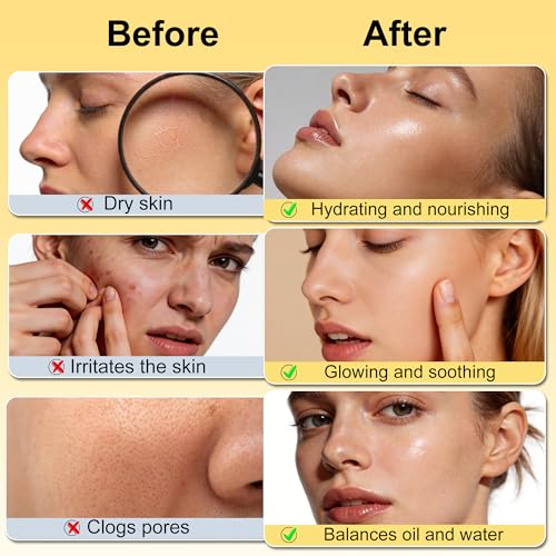 Skin Care Set w/Korean Rice Extract for Hydration,Glow,Repair &Radiant Skin