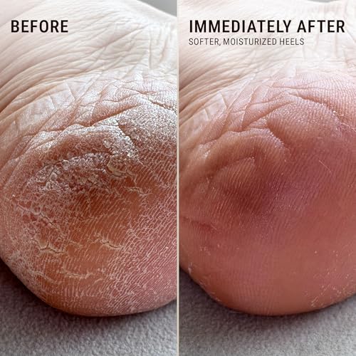 VOESH Solemate Heel Repair Balm, Heel Moisturizer & Repair, Balm for Rough and Cracked Heels, Foot Care