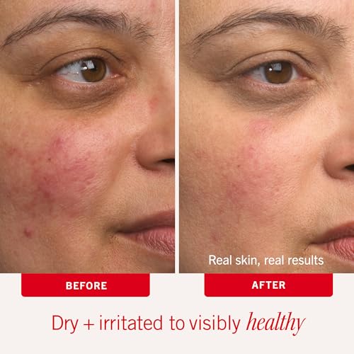 First Aid Beauty Ultra Repair Cream, Intense Hydration - Clinically Tested Face & Body Moisturizer with Colloidal Oatmeal - Supports Eczema & Dry Skin Barrier Repair - Fragrance Free - 6 oz