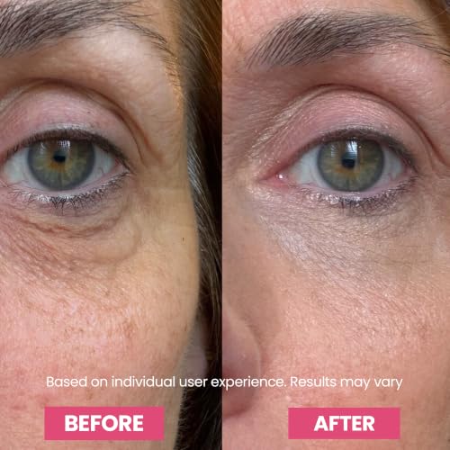 Luxe Korean Under Eye Balm – Lift & Firm 3-in-1 Multi Balm Stick, Hydrating, Smoothing, and Refreshing Eye Care for Dark Circles, Puffiness, and Fine Lines, with PDRN Collagen Extract