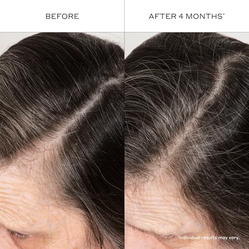 Zenagen Densifying Hair Serum | Boosts Hair Density 1.7 Fl Oz