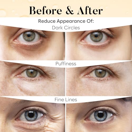 BLOOMORA Vitamin C & Caffeine Under Eye Patches (30 Pairs), Under Eye Mask for Puffy Eyes, Appearance of Dark Circles, Smoothing & Hydration, Self Care & Skincare Gifts for Women, Patch Yeux