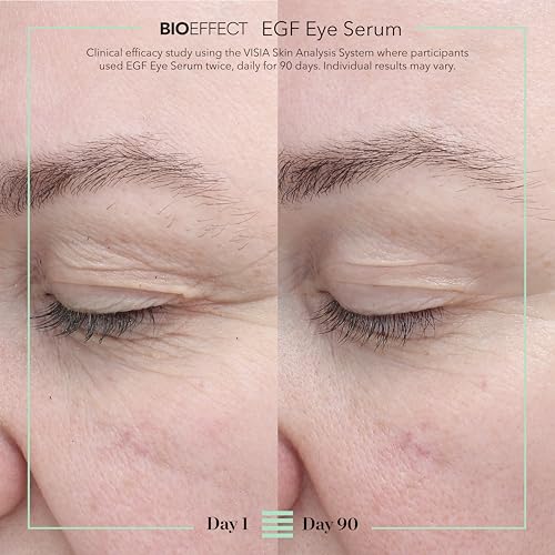 BIOEFFECT EGF Eye Serum with De-Puffer Rollerball | Age Defying, 0.20 Fl Oz
