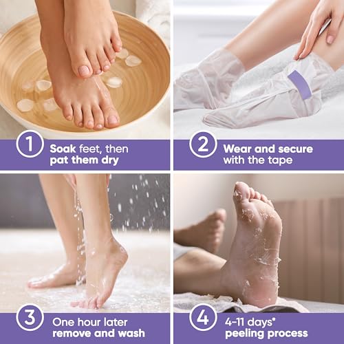 CÉLOR Foot Peeling Mask for Dry Cracked Feet | Foot Mask to Exfoliate Rough, Cracked, Dry Feet, Calluses for Soft Baby Feet Results | Made with Aloe Vera Extract for Women & Men (2 Pairs) | Lavender