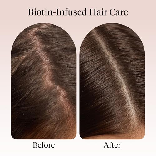 Kitsch Rosemary Oil for Hair Growth -With Castor Oil, Biotin & Jojoba- 60mL