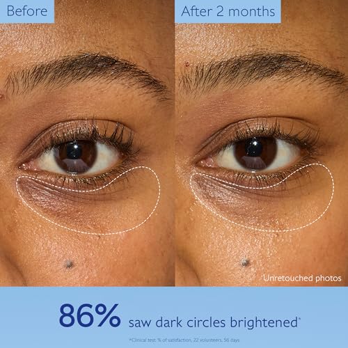 Caudalie Vinoperfect Dark Circle Brightening Caffeine Eye Cream - 15 mL