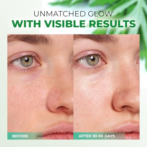 Caresilk Mugwort Essence,Hydrating Face Toner with Artemisia, Hyaluronic Acid, Centella Asiatica & Rosemary Extract - Deep Moisturizing Skin Care & Barrier Protection Face Mist - 150 ml