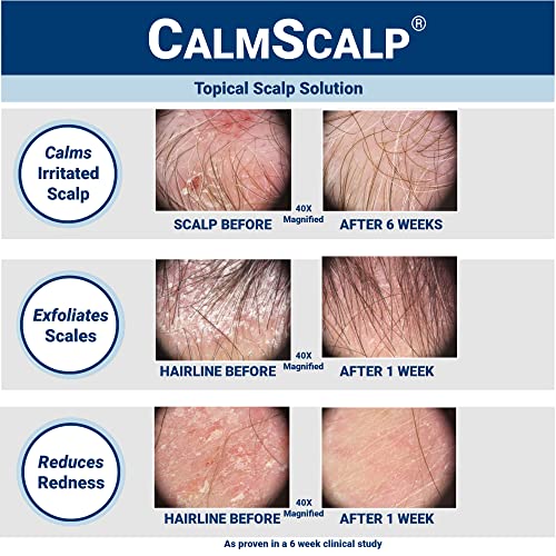 CalmScalp Leave-In Scalp Serum