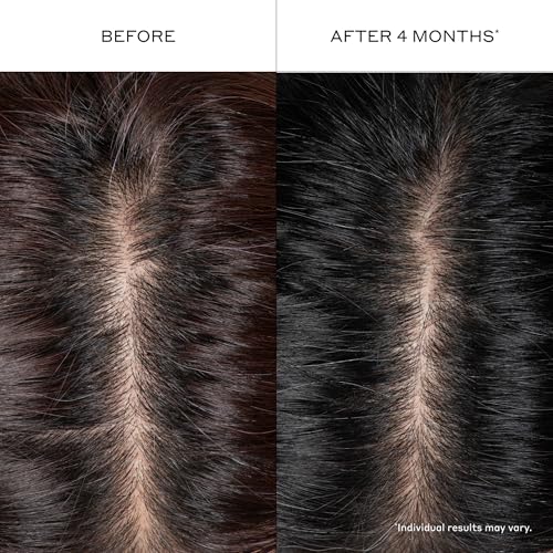Zenagen Densifying Hair Serum | Boosts Hair Density 1.7 Fl Oz