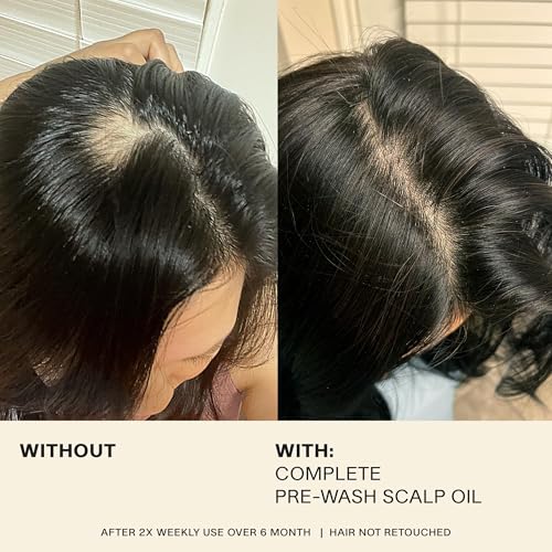 JVN Complete Pre-Wash Scalp Oil, 1.7 Fl Oz