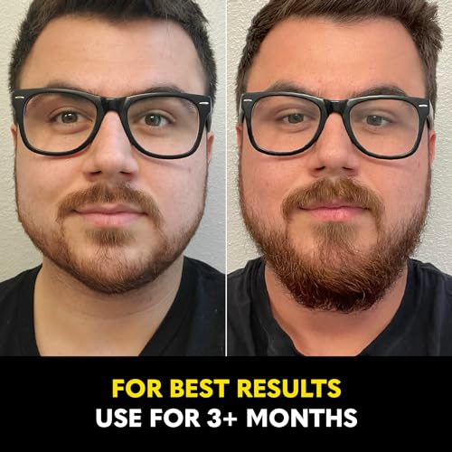 The Beard Club - Beard Growth Oil with Natural Castor & Avocado to Grow Thicker, Fuller Facial Hair, Fill in Patches and Stimulate Healthier Facial Hair Growth