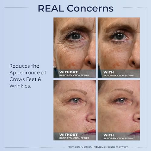 Plexaderm Eye Serum Pump - Visibly Reduces Bags, Wrinkles & Dark Circles