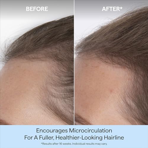 Briogeo Destined for Density Caffeine + Biotin Peptide Density Serum | Increases Hair Thickness & Volume for Fine or Thinning Hair | Fast-Absorbing & Non-Greasy | Fragrance-Free | Vegan & Cruelty-Free
