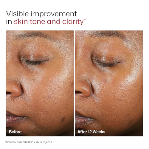 EltaMD UV Clear Untinted Face Sunscreen with Zinc Oxide, SPF 46, 1.7 oz