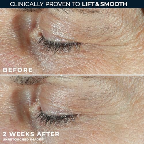 RoC Derm Correxion Dual Eye Cream, Retinol + Peptides for Puffy Eyes 0.68oz