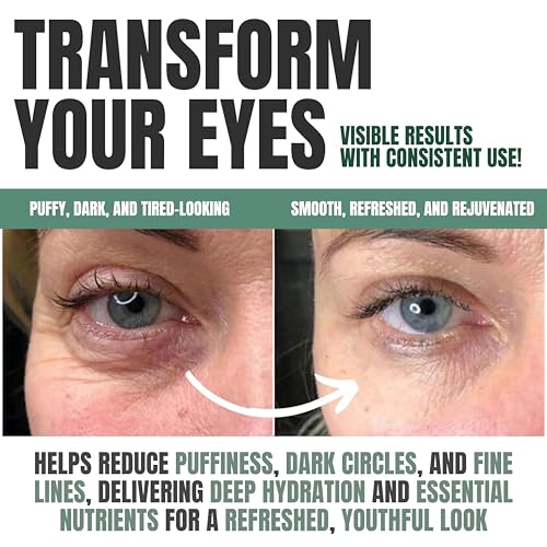 Alozera Wake Up Under Eye Gel Cream with Aloe Vera, Collagen & Cucumber, Anti-Aging, Hydrating, Soothing & Cooling Treatment for Dark Circles, Puffiness and Under Eye Bags, Fast-Absorbing, Day & Night