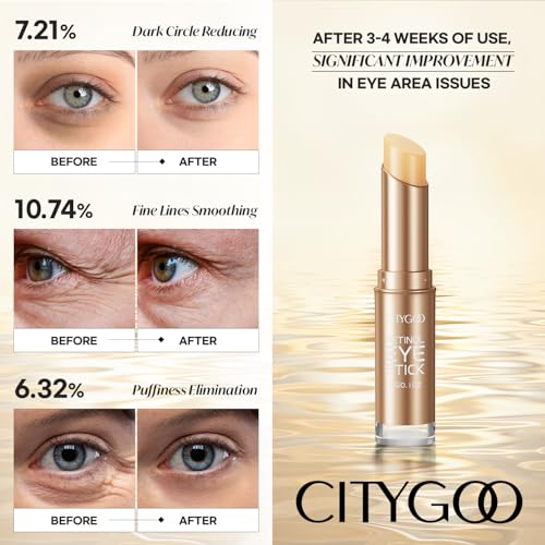 CITYGOO Retinol Eye Stick With Collagen, Hyaluronic Acid For Dark Circle, Under Eye Cream Anti Aging, For Puffiness and Bags Reduces Fine Lines