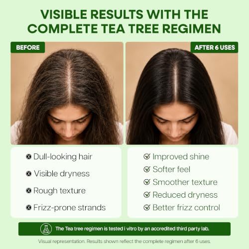 Botanic Hearth Tea Tree Scalp Oil for Hair Growth & Itchy Scalp, 6.7 Fl Oz