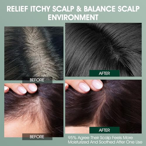 VOERUY Scalp Treatment, Rosemary Refreshing Scalp Treatment with Tea Tree, Clarifying Build Up & Purifying, Leave-In Scalp Detox for Dry Itchy Scalp,Vegan & Cruelty-Free,120ML