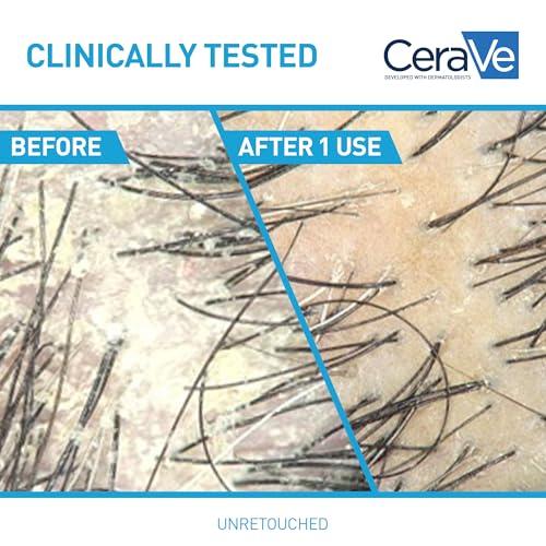 CeraVe Hydrating Anti Dandruff Shampoo, Itchy Scalp Treatment, 12oz