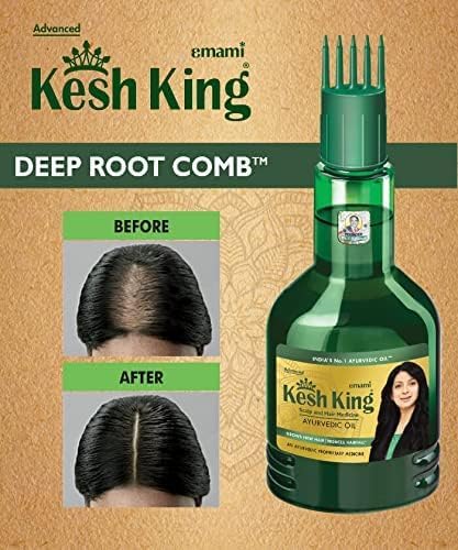 Kesh King Ayurvedic Hair Oil | Herbal Oil with Bhringraj & Amla | Enhance Hair Growth | Reduce Hairfall | Nourishes Scalp | Provides Long & Thick Hair | 1.69 Fl Oz/50ml