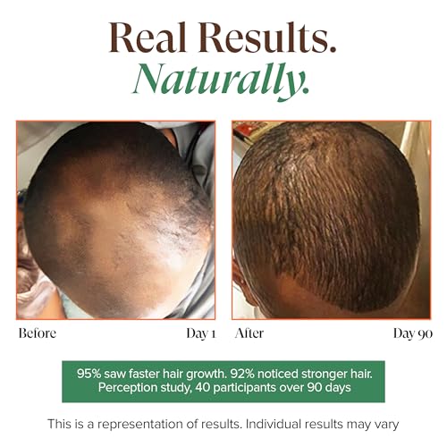 Kreyol Essence - Haitian Black Castor Oil for Skin and Hair, Glass Bottle - Cold Pressed Castor Oil, Fuller-Looking Hair, Hexane Free, Natural Humectant | 3.4 Fl Oz | Rosemary Peppermint