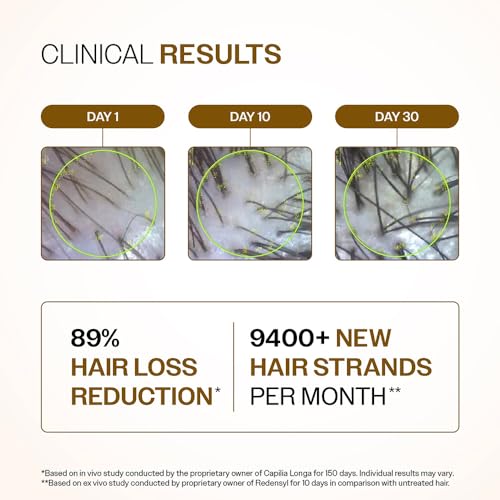 Bare Anatomy Advanced Hair Density Serum | 3% Redensyl, 4% Anagain, 3% Baicapil, 1% Capilia Longa, Rosemary, Biotin & Rice Extract | Reduces Hair Fall, Supports Hair Growth for Men & Women | 30 ml