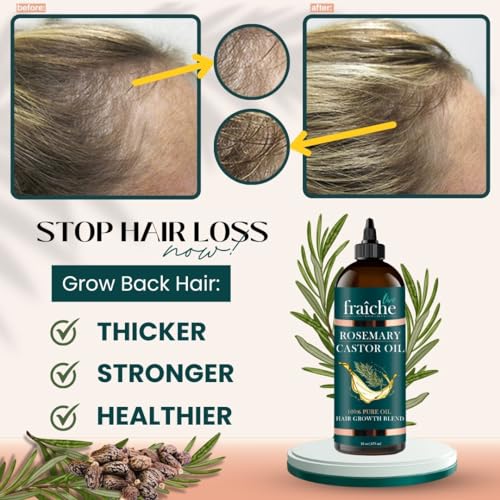Essential Rosemary Castor Oil for Hair Growth Scalp Oil Hair loss Treatment
