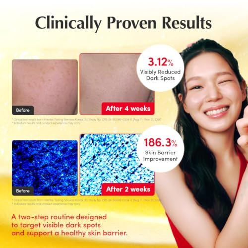 EQQUALBERRY Vitamin C Dark Spots & Brightening Duo | Vitamin Illuminating Serum & Cream with Niacinamide, TXA & Ceramides | Korean Skincare Set for Even Tone & Glow