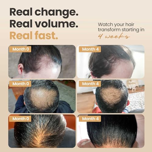 Vitasei Hair Booster Revitalizing Hair Care Serum – 2oz (1 Pack)